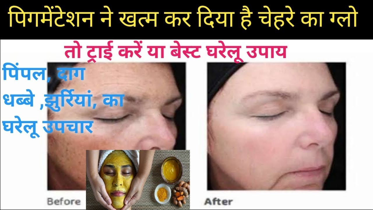 pigmentation ka gharelu upchar,चेहरे का ग्लो बढ़ाने के लिए ट्राई करें