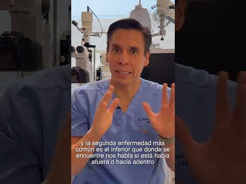 ¿Qué es la malposición palpebral #drrenedavila #oftalmologia #malposiciónpalpebral