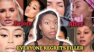 Why Everyone Is Dissolving Their Fillers