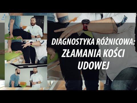 Diagnostyka różnicowa: Jak wykluczyć złamania kości udowej?