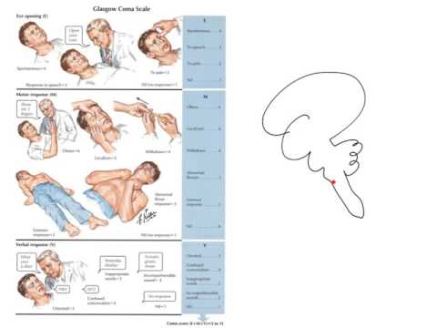 Principles of the glasgow coma scale