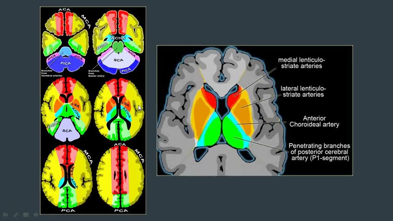 Taller de Neuroradiología