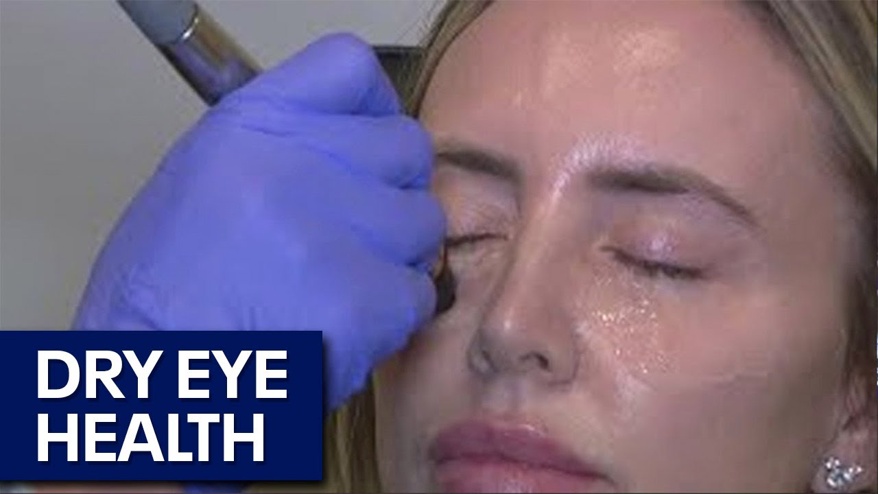 Dry eye treatment and prevention with Dr. Vu