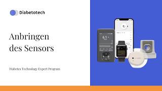 Dexcom ONE Plus  | Platzieren des Sensors | Diabetotech