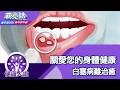 關愛您的身體健康 白塞病難治癒【蔣亮話】健康人生 20260523｜加聯泰平醫療網家庭科醫師 王恬恬