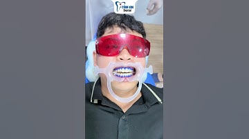 Tẩy trắng răng tại Nha khoa Tâm An