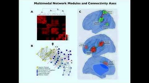 Jorge Sepulcre - Large-Scale Connectome of the Modal Brain