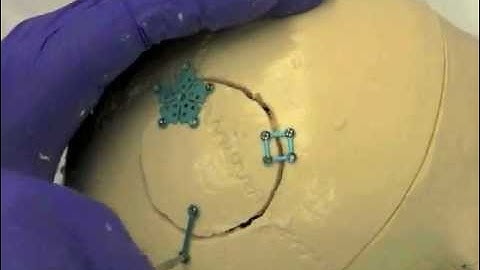 Cranial Flap Fixation