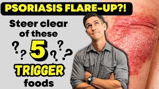 Psoriasis Treatment Diet: 5 Foods You NEED To Eliminate