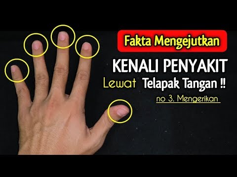 Video: Retak Buku Jari: Penyebab, Efek Samping, Dan Kiat Berhenti