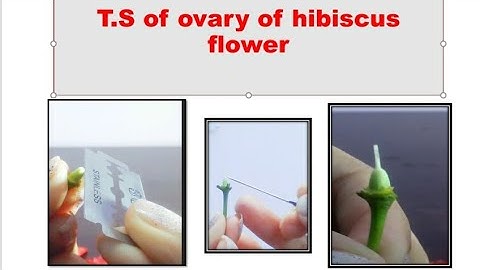 Transverse section ( T.S ) of ovary of hibiscus flower.