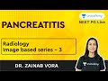 Radiology | Pancreatitis Image-based questions Episode 3 with Dr. Zainab Vora