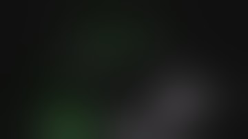 ICG guided PN for complex renal tumor 2