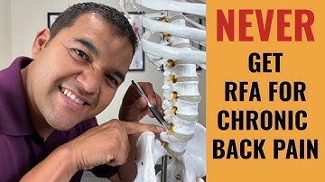 Why You Should Never Get A Radiofrequency Ablation For Chronic Back Pain