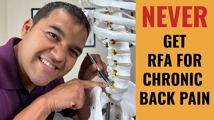 Why You Should Never Get A Radiofrequency Ablation For Chronic Back Pain