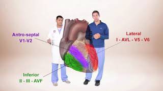 ECG for Beginners. ECG Diagnosis of ST Elevation Myocardial Infarction (STEMI)