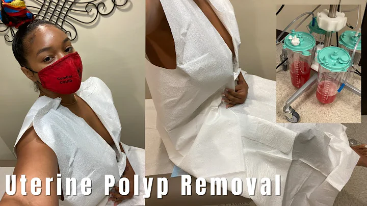 Comprehensive Guide to Uterine Polyp Removal: Pre-Op & Surgery Day