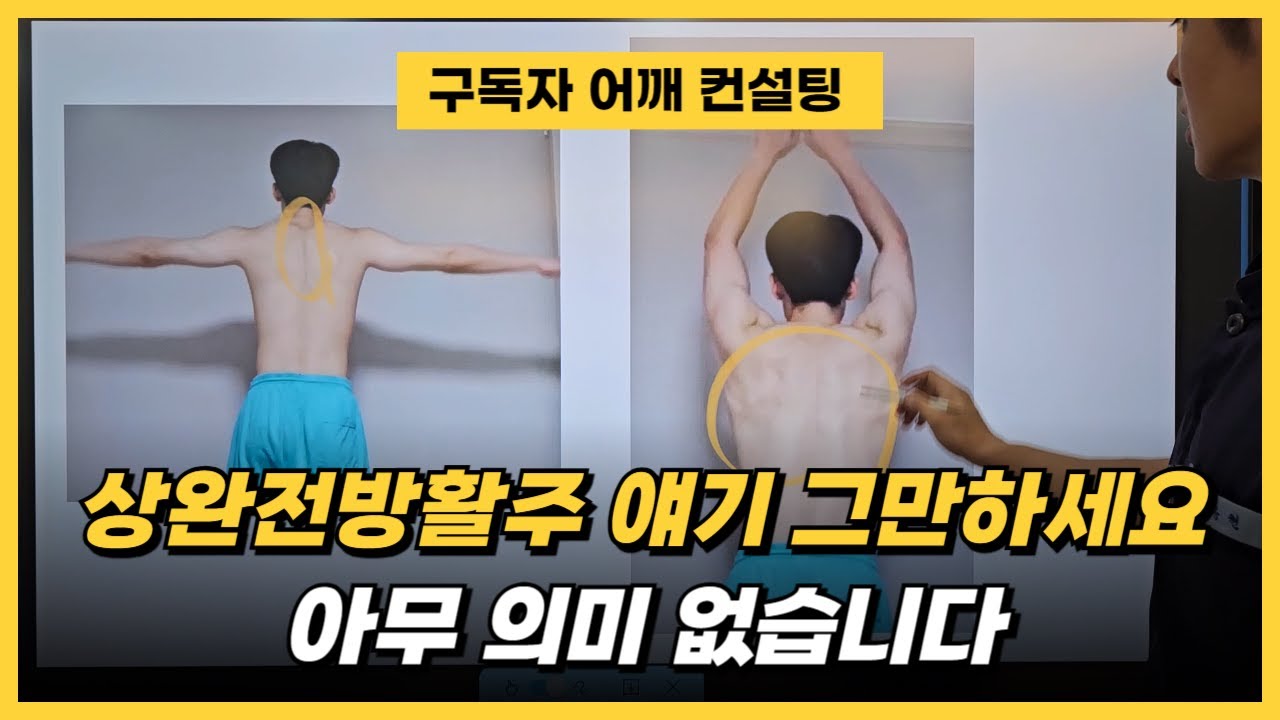 [구독자 어깨 컨설팅] 상완전방활주? 아무 의미 없습니다