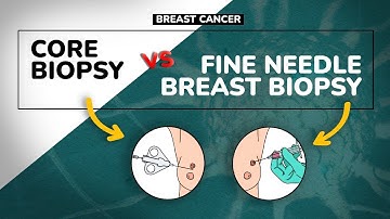 BREAST BIOPSY | Core VS Fine needle | Best breast cancer diagnosis.