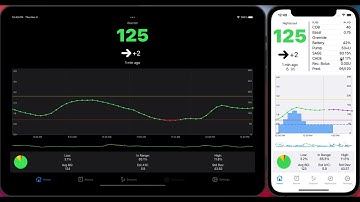 Loop Follow Tutorial 1: Display and Data Sources