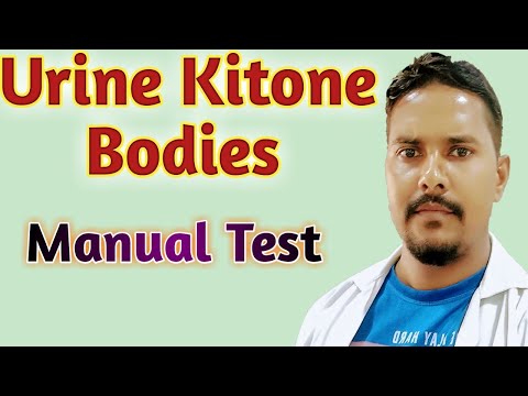 urine ketone test | urine ketone bodies test |  How to use kitone test strips | ketone test strips