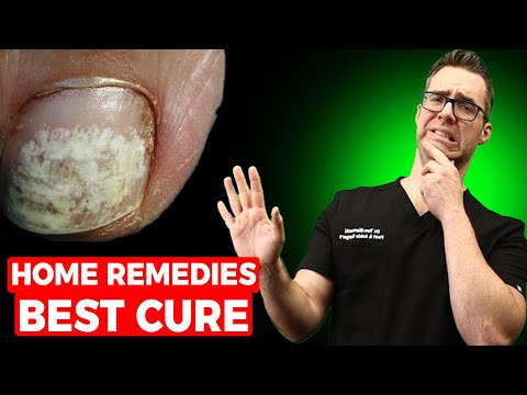 White Toenails After Polish or Pedicure? [Home Remedies & Best Cure!]