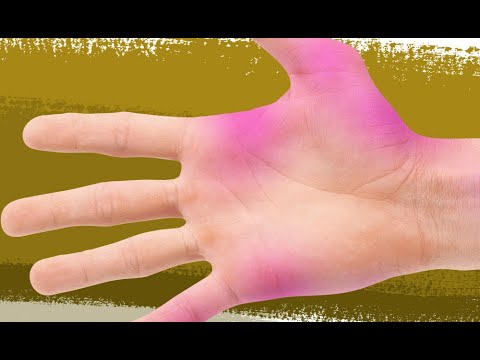 How to remove food coloring stains from skin