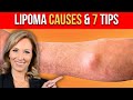 Lipoma Causes : 7 Tips to Get Rid of Them | Dr. Janine