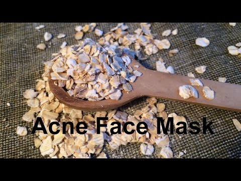 DIY How To Get Rid Of Acne FAST | Oatmeal for Acne, Scars, Uneven Skintone