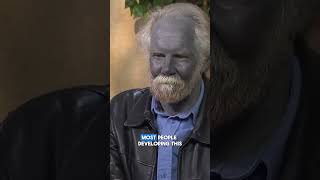 The Man With Strange Blue Skin - Paul Karason