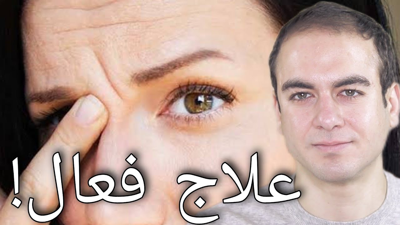 Эффективное лечение морщин на лбу и бровях!