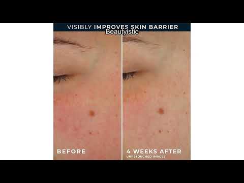 RoC Barrier Renew Day Cream with SPF 30 Review: Is It Worth It?