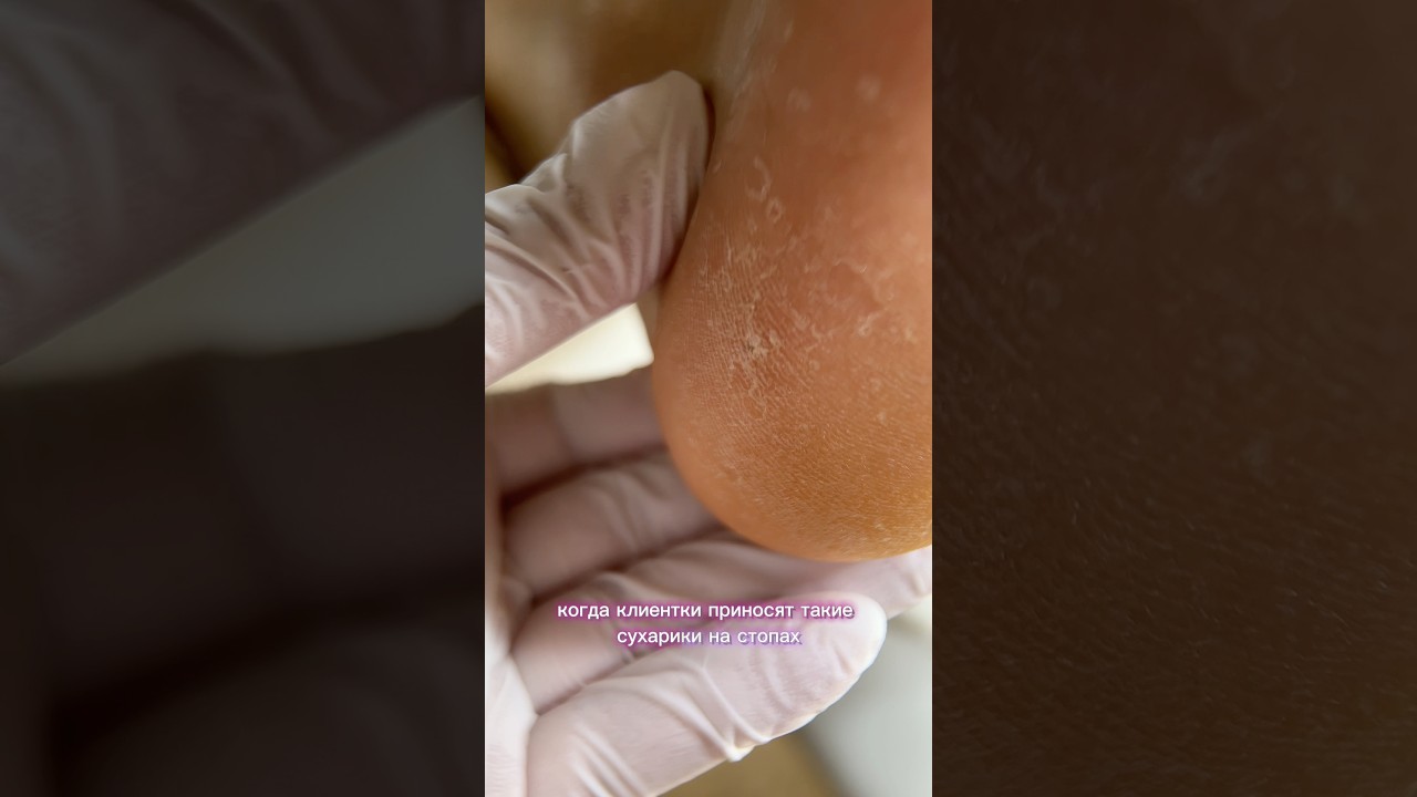 Процесс обработки стоп,который надолго сохранит эффект от процедуры💜