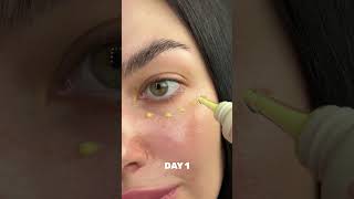 Ви бачите, як прибрались ці мікро заломчики? Я в шоці#ksecret #seoul1988 #retinal #eyecream #eyebags