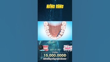 [3D] NIỀNG RĂNG || Nha Khoa Quốc Tế Athena