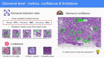 HuBMAP - Hacking the Kidney Scientific Winner: DeepLive.exe