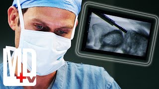 Doctors Must Fuse Vertebrae with a Screw on a 10% Success Rate Surgery  | Do No Harm | MD TV