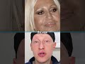 Donatella Versaces NEUES GESICHT Reaktion Des Schönheitschirurgen