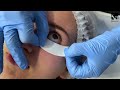 Video: Foam Eye Patches Roll - 110 patches