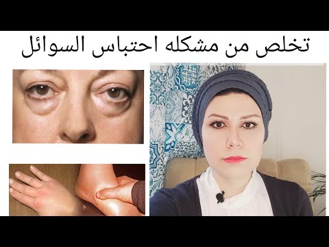 تخلص من مشكله احتباس السوائل احمي نفسك من ضغط الدم المرتفع