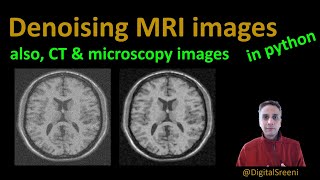 94 - Denoising MRI images (also CT & microscopy images) screenshot 2