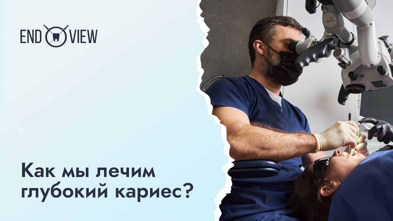 Глубокий кариес - симптомы, диагностика и лечение под микроскопом - YouTube