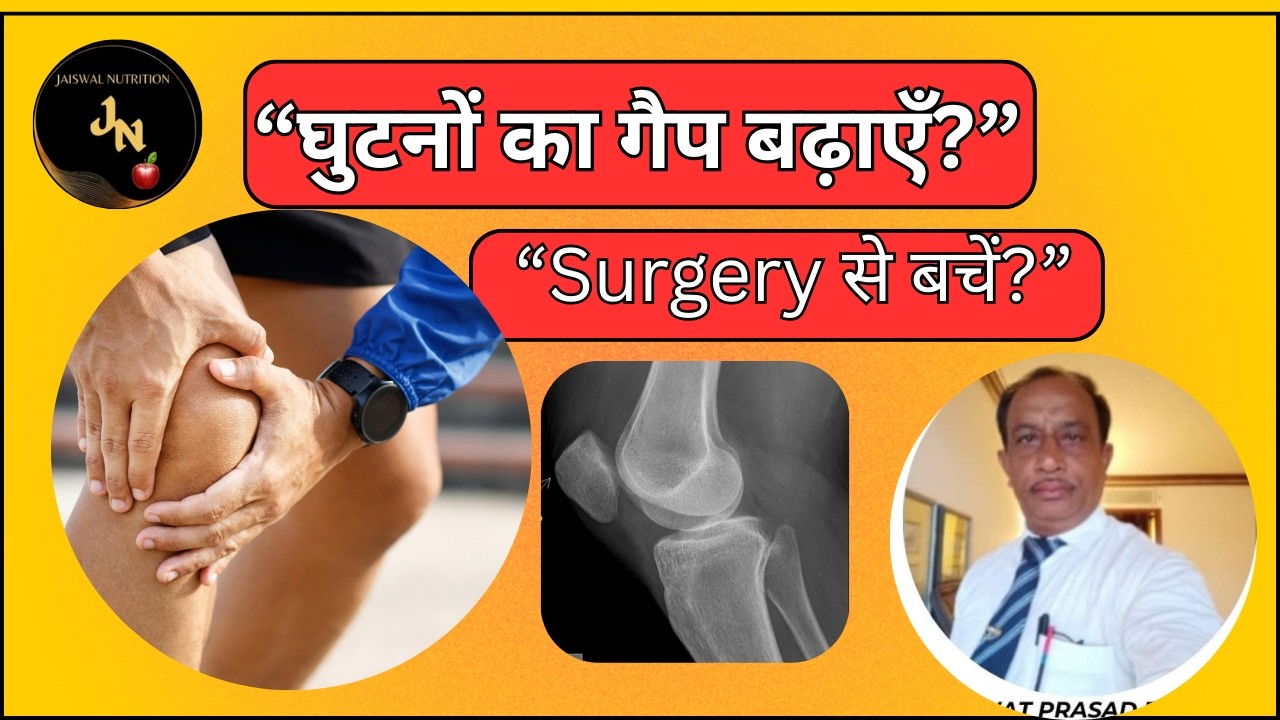 क्या आपके घुटनों का गैप कम हो गया है, या घुटने टेढ़े दिखते हैं? - YouTube