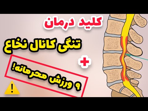 تصویری: تاندون پرونئال کجاست؟