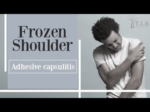Video: Kako liječiti adhezivni kapsulitis?
