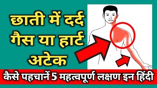 Chest Pain in hindi ( गैस का दर्द या हार्ट अटेक) || Gas Or Acidity Pain || Chest Pain Or Gas Ka dard