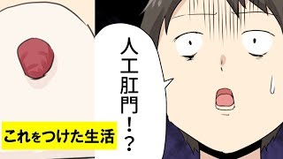 突然のガン宣告！人工肛門を取り付ける事となった男の裏側【マンガで分かる】