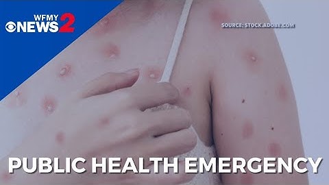 Monkeypox declared a public health emergency: What does that mean?