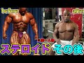 やっぱり危険?ステロイドの副作用を受けた人たち【筋トレ】