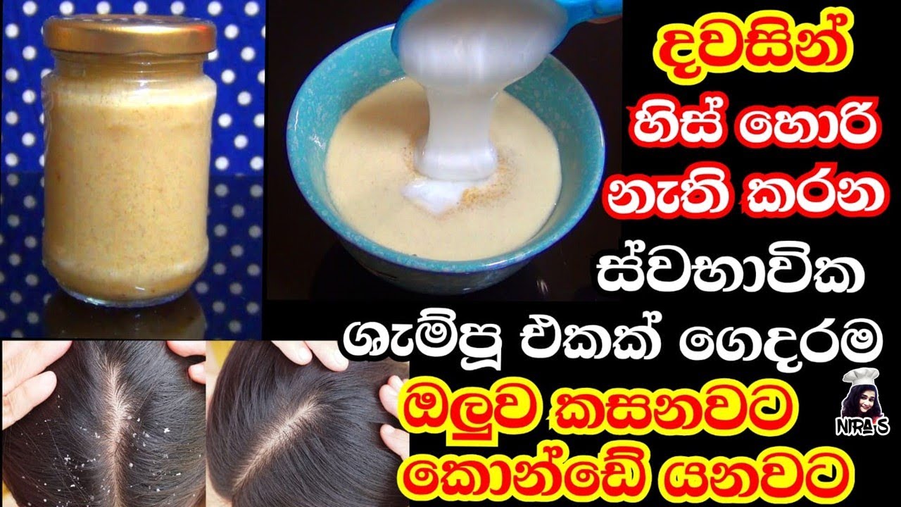 හිස් හොරි දවසින් නැති කරන ස්වාභාවික ශැම්පූ එකක් ගෙදර හදමු | natural anti dandruff shampoo | his hori